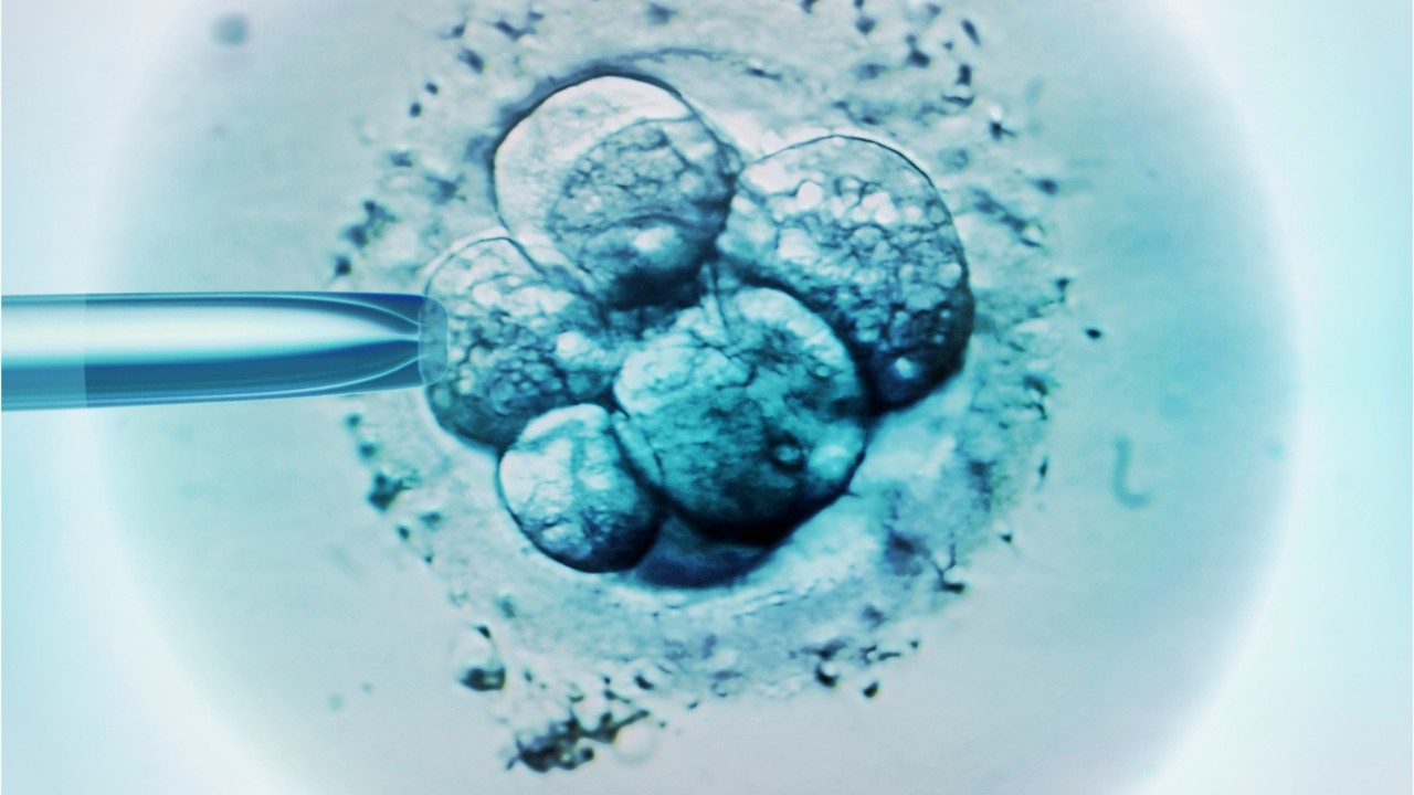 Couple sues fertility clinic after DNA test reveals daughter fathered by stranger