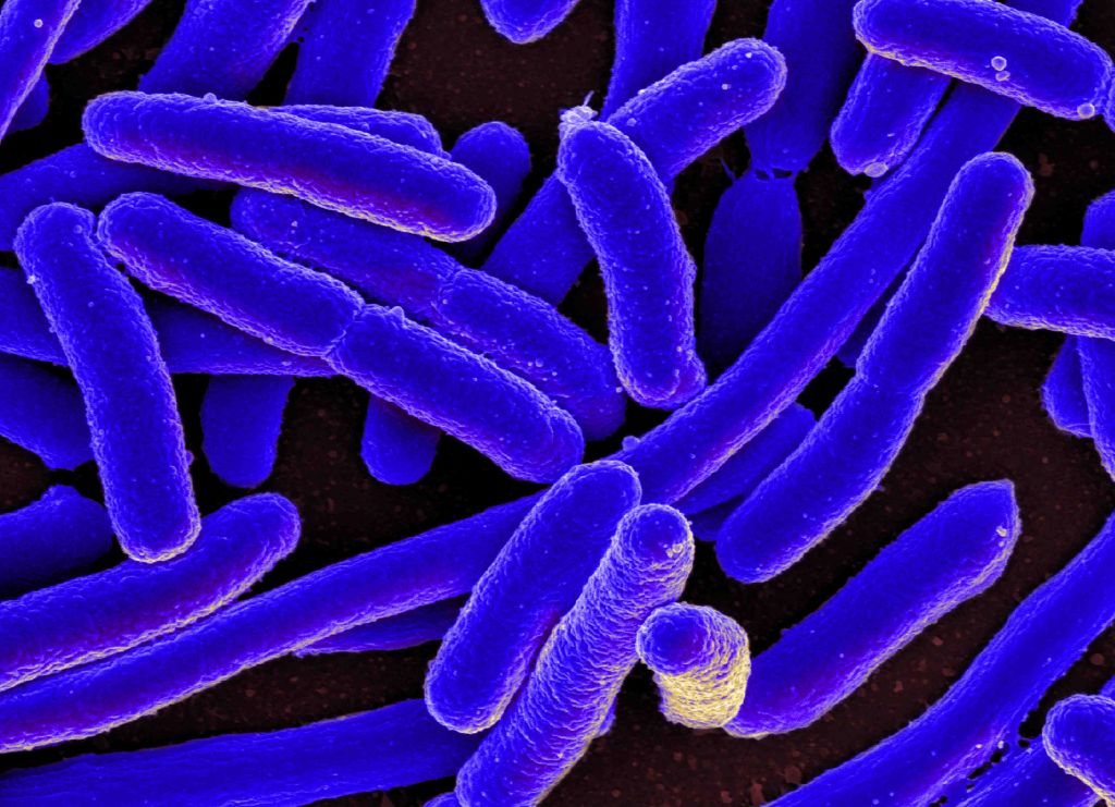 E. coli: How it spreads, symptoms and how to prevent illness